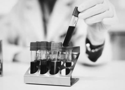 با رشته هماتولوژی و کار هماتولوژیست آشنا شوید با رشته هماتولوژی و کار هماتولوژیست آشنا شوید